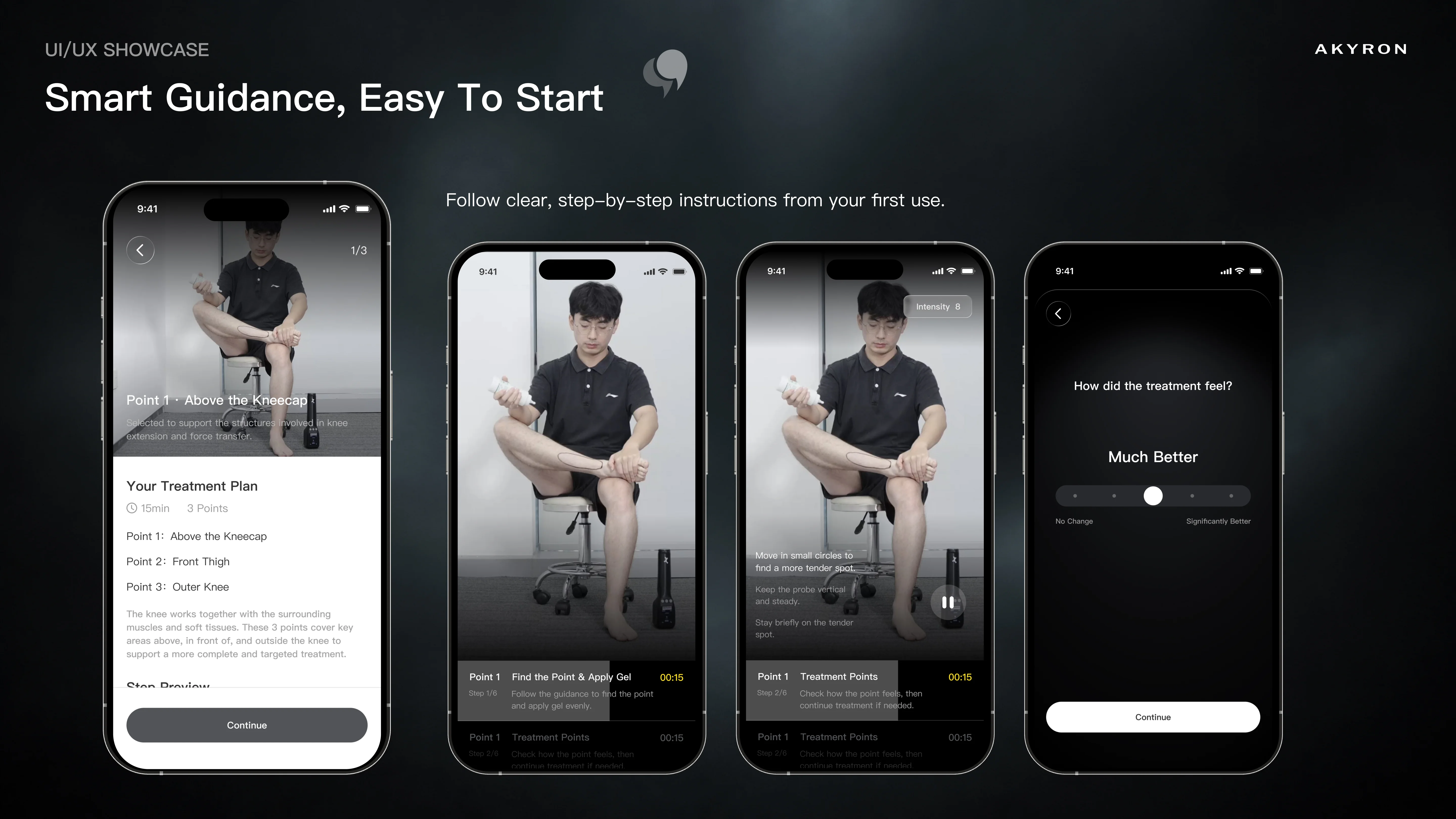 Akyron App 分步视频指引及使用感受反馈界面设计