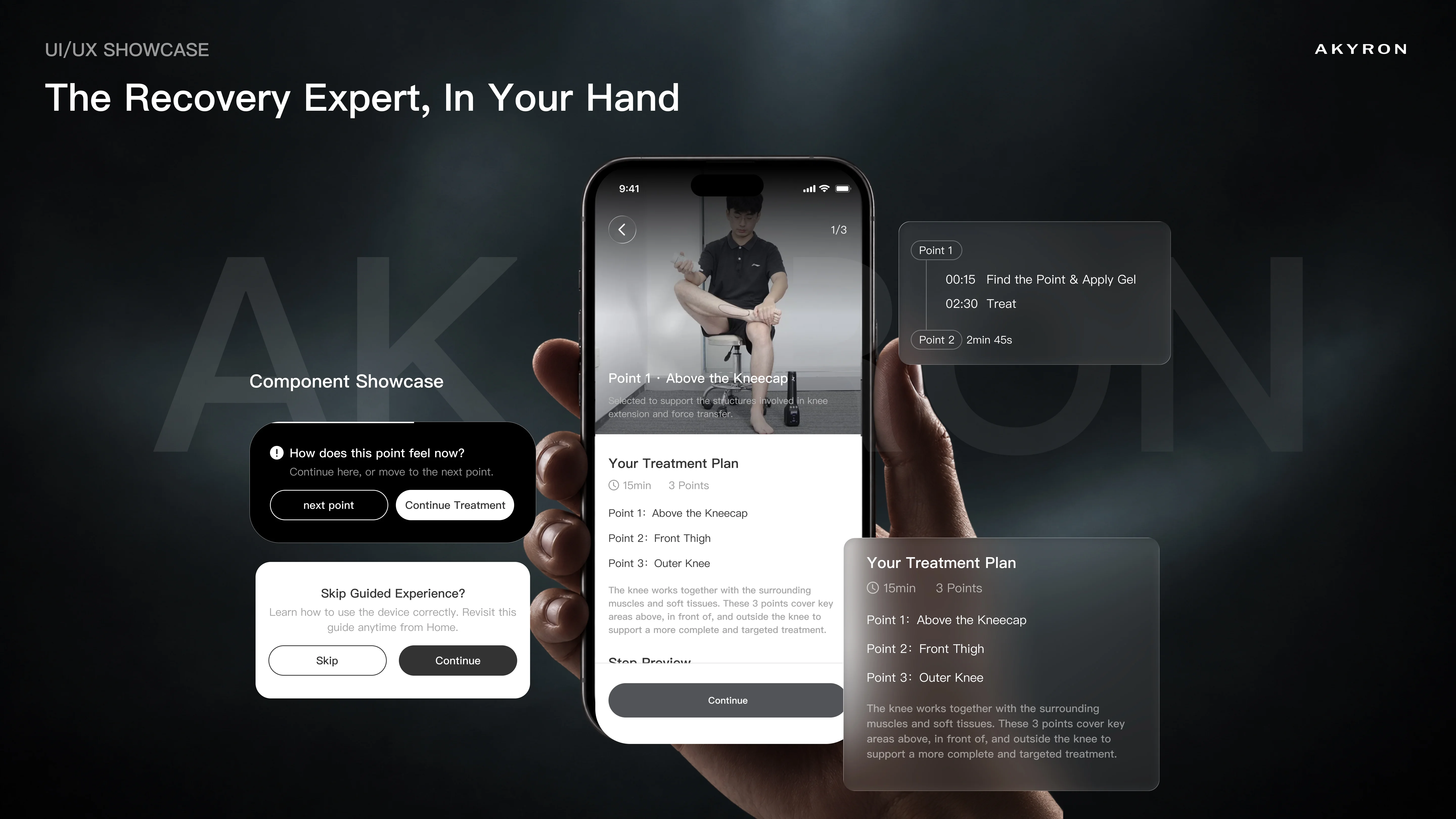 Akyron App 方案概览设计,展示步骤预览与使用流程